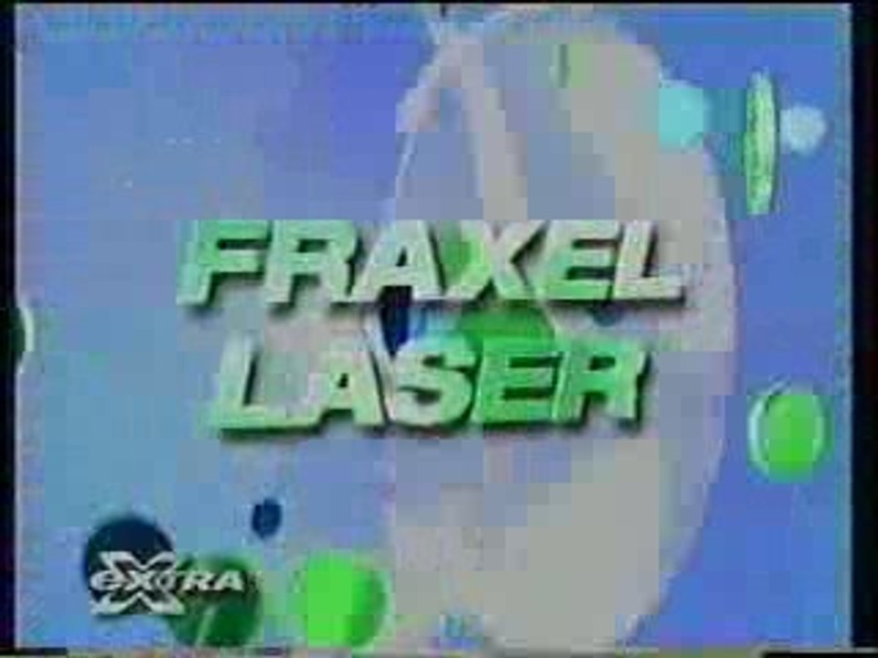 Microdermabrasion and Fraxel Laser Treatments - Makeover You