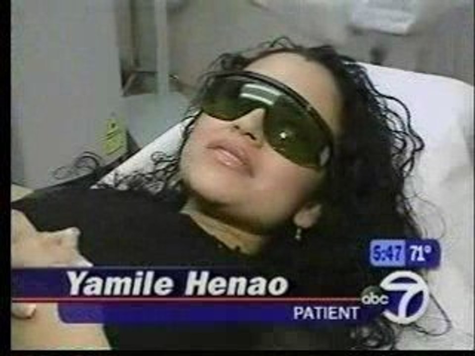 Titan Skin Tightening - Dr. David Goldberg in New York