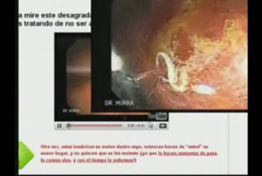 como perder peso-el mejor metodo para quemar calorias