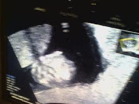 léco a ma cousine marina