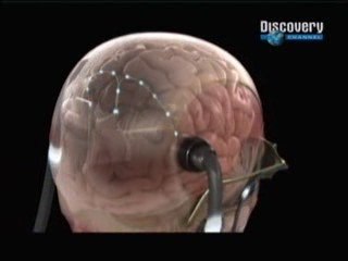 Vision artificial: Cerebro humano