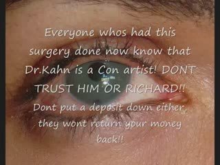 NewIris makes patients take medication for life