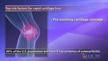Obesity Linked To Cartilage Loss, Osteoarthritis