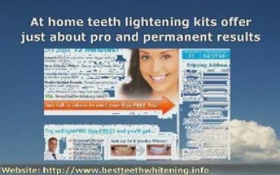 What are the Best At Home Teeth Whitening Kits