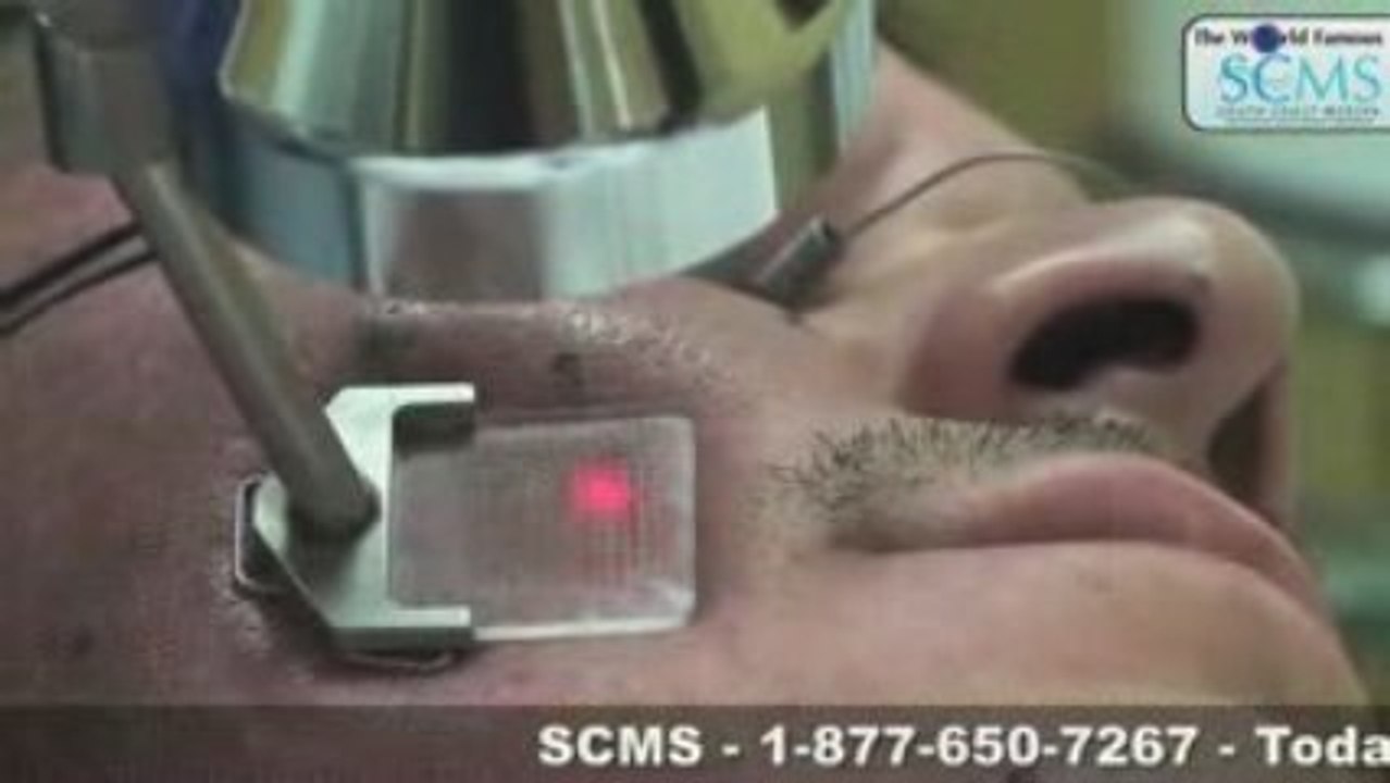 Laser Acne Removal