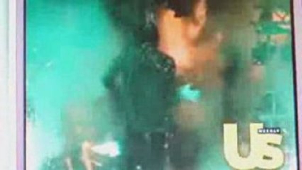 The Pepsi Commercial that burned Michael Jackson