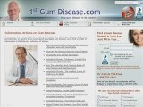 Find a Gum Disease Dentist for Swollen Gums