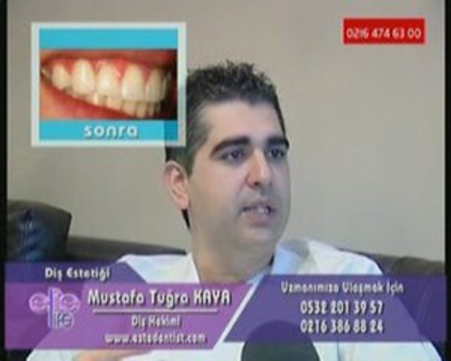 Dis Bakimi, Dis Estetiği