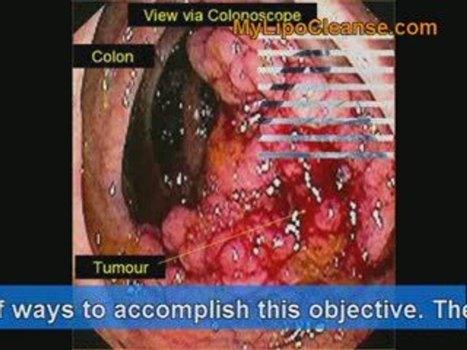 Almighty Colon Cleanse