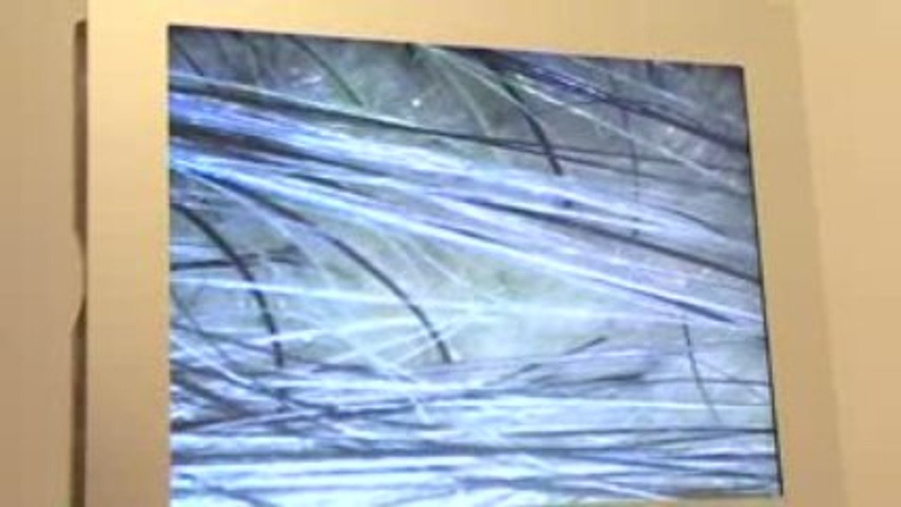 TRATAMIENTO CAPILAR MICROCAMARA (Instituto Capilar)