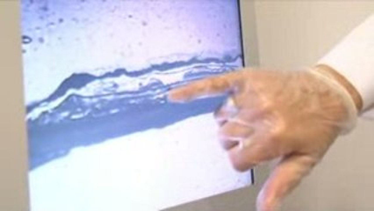 TRATAMIENTOS CAPILARES MICROSCOPIO (Instituto Capilar)