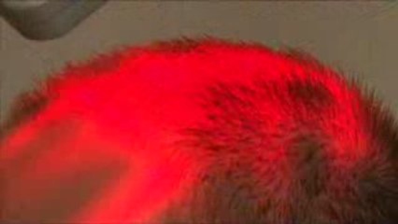 TRATAMIENTOS CAPILARES LASER DIODO (Instituto Capilar)