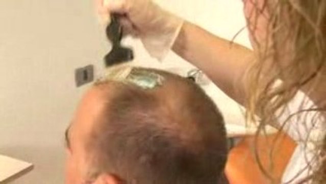 TRATAMIENTOS CAPILARES INSTITUTO CAPILAR CATALAN