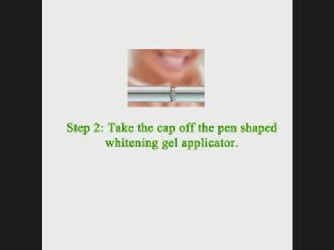 Free Teeth Whitening System: Results of Teeth Whitening, How