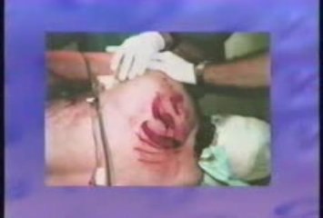 MUST SEE - Great White Shark Attack!, versus vs