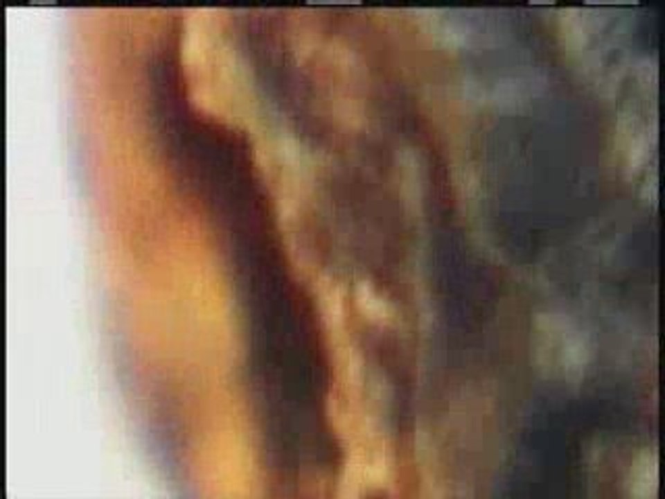 rabo de manzana - apple stem