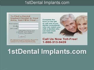 Need Dental Implants?