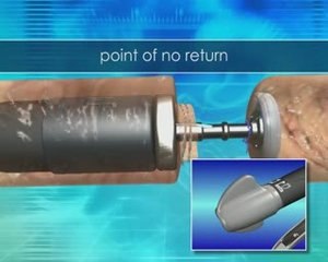 colon surgery | colorectal surgery | anastomoses