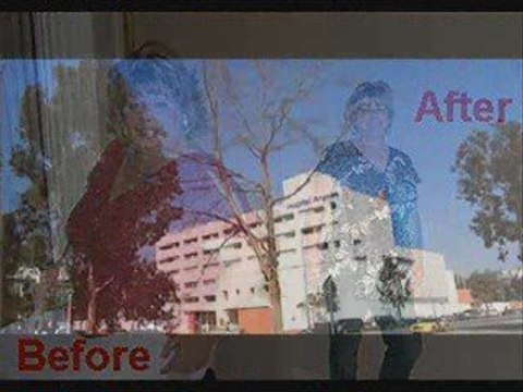 Affordable Surgical Weight Loss Surgery Gainesville Fl