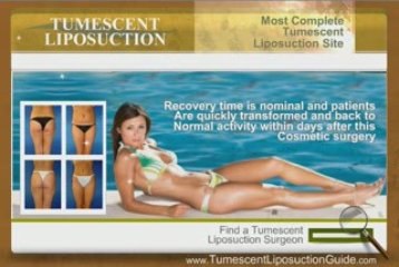 Tumescent Liposuction # 4