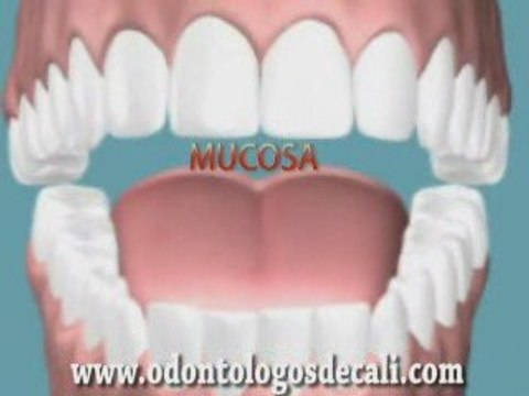 Periodoncia Odontologos de Cali Colombia