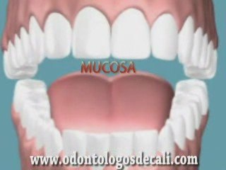 Periodoncia Odontologos de Cali Colombia