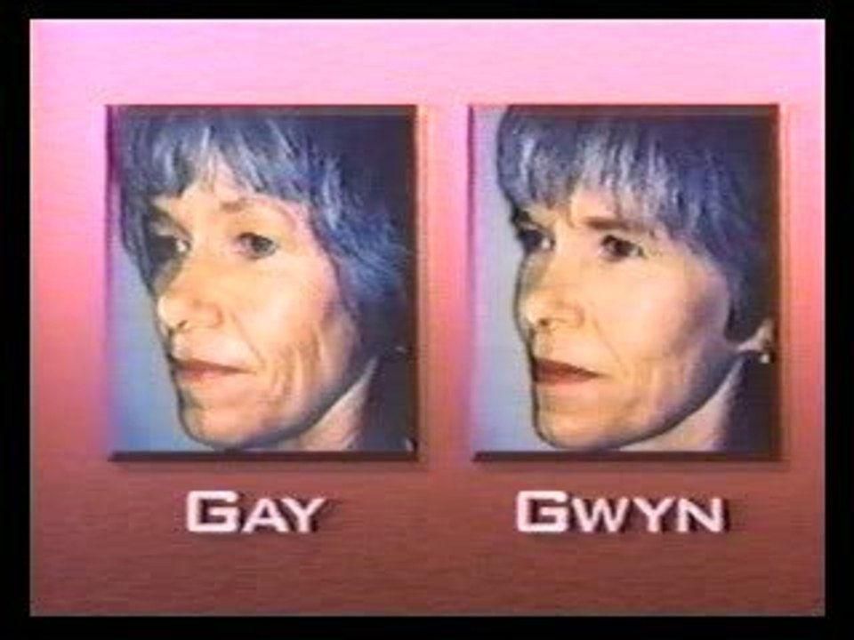 Facelifts make twins look the same again
