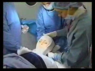 Identical twins, aging, and facelifts