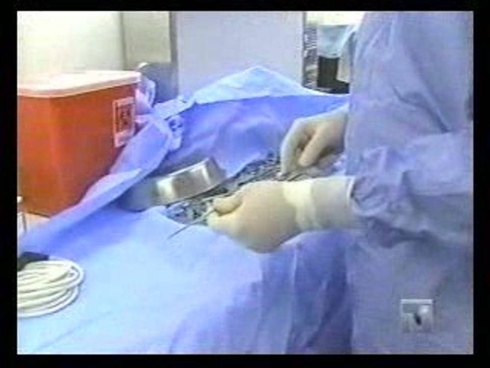 Liposucción ultrasónica en Nueva York