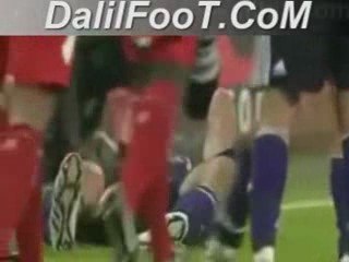 La pire blessure dans le championnat belgique 30 08 2009