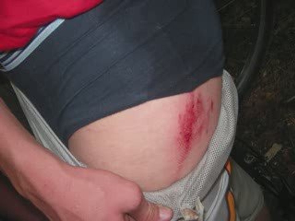 blesur velo