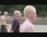 Albino United
