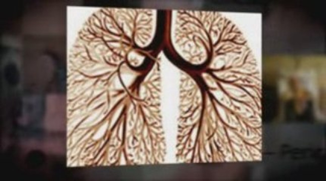Port St. Lucie, FL Mesothelioma Lawyer