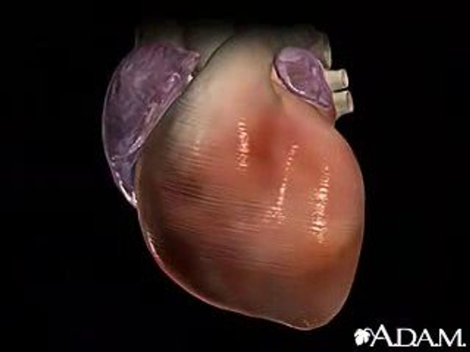 Cardiac Arrhythmia 