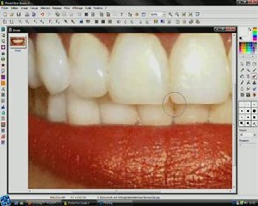 blanchir les dents