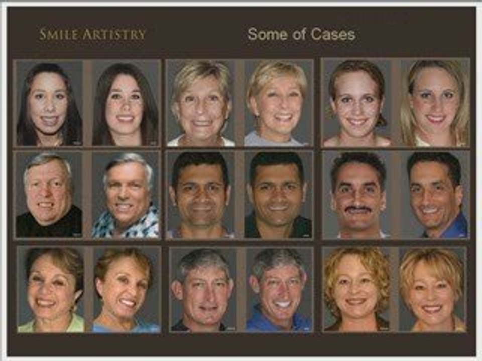 Seattle Cosmetic Dentist