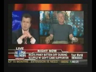 Man Gets Finger Bitten Off At Healthcare Rally