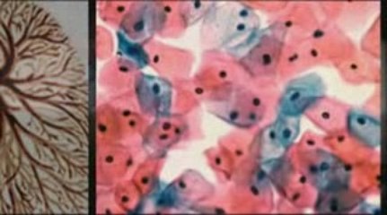 Baton Rouge, LA Mesothelioma Lawyer