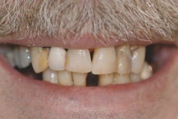 Sacramento Cosmetic Dentist