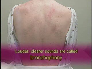 Full Respiratory Examination-Part2
