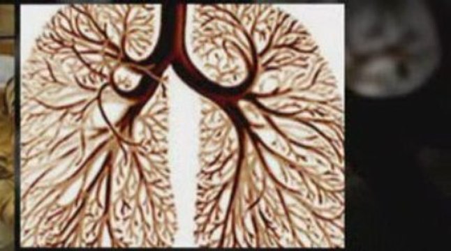 Las Vegas, NV Mesothelioma Lawyer