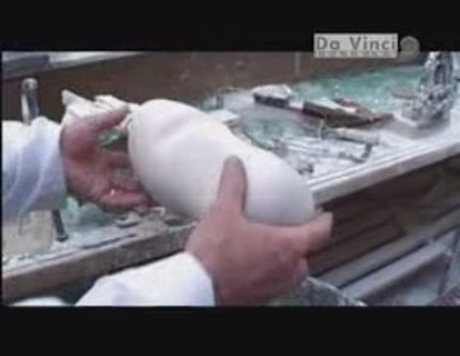 ampute yapay el ve ayak