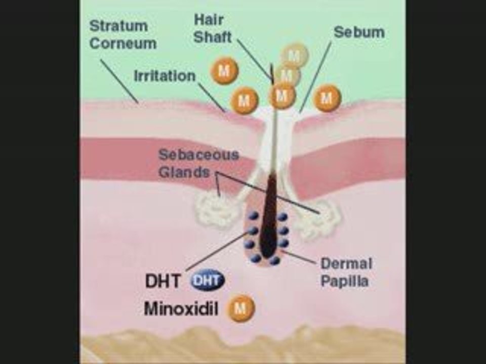 Provillus Hair Loss Treatment Reviews by Recoveryhair.com