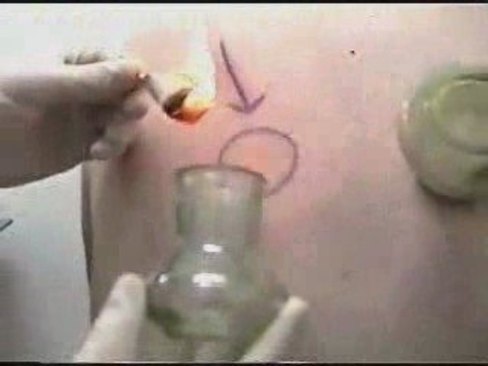 -كيف تصبح حجاما تعليم الحجامة فيديو-‎