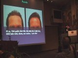 Hair Transplant 2/Cedars-Sinai/Los Angeles/Beverly Hills