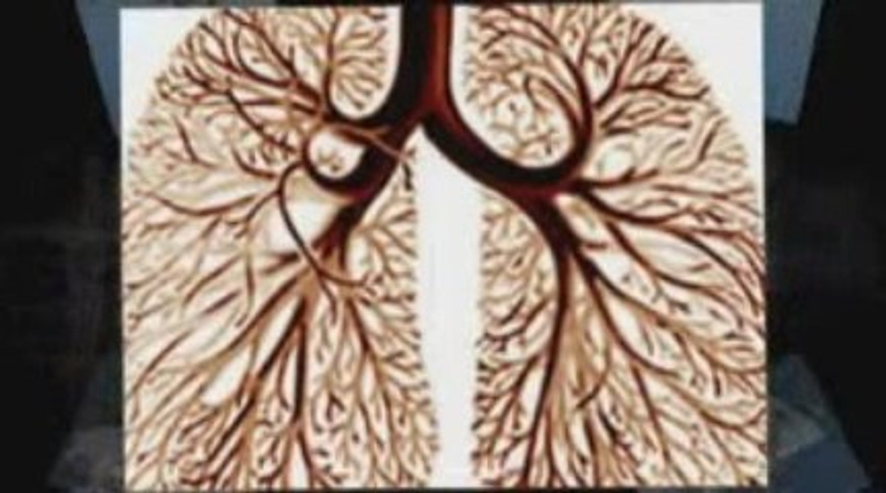Dayton, OH Mesothelioma Lawyer