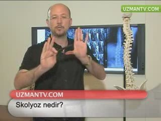 Skolyoz nedir