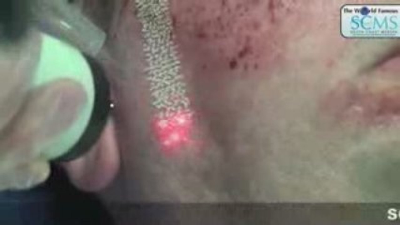 FX Profractional
