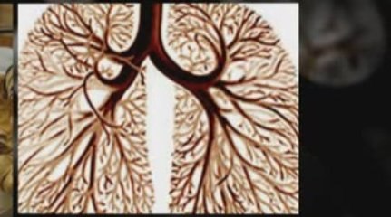 Oklahoma City, OK Mesothelioma Lawyer