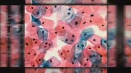 Providence, RI Mesothelioma Lawyer